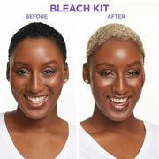 SoftSheen-Carson Interbeauty Dark and Lovely® Uplift Bleaching Kit for Blonde Hair, Includes Bleach Powder, Developer, and...