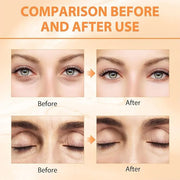 2PCS Revive Glow Vitamin C Eye Balm, Reducing Dark Circle,Hydrating Eye Cream,Improve Dark Circles,Reduces Puffiness (3pcs...
