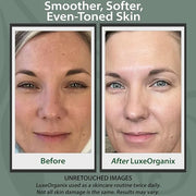 Organic Vitamin C Face Moisturizer with Anti-Aging, Brightening, and Wrinkle-Smoothing Properties. - Product Image