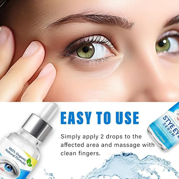 Stye Eye Treatment, Natural Stye Eye Relief Serum, for Styes Chalazion and Blepharitis Treatment, Restored Healthier Eye S...