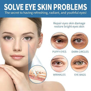 Zetiling 8 Pack Reusable Ice Gel Eye Pad for Puffy Eyes, Hot Cold Eye Mask, Deep Hydration and Anti Aging Effects - Produc...