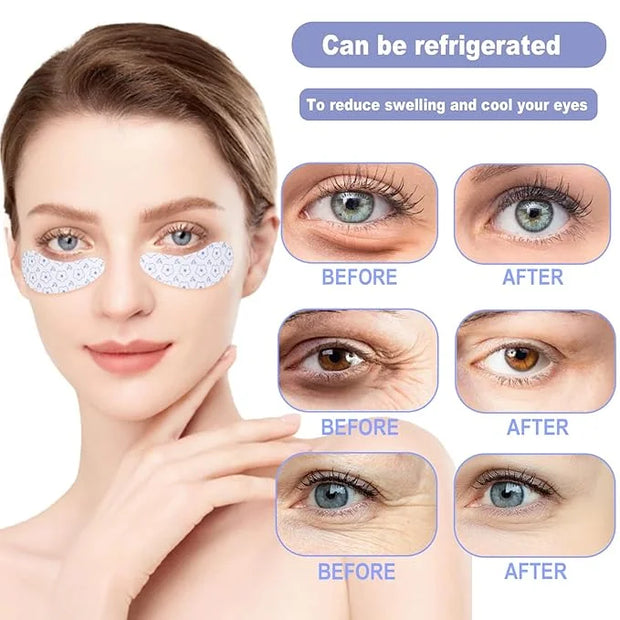 Reusable Eye Patches, 2 Pairs Silicone Under Eye Patches for Fine Lines & Dark Circles with Metal Eye Cream Applicator, Vi...