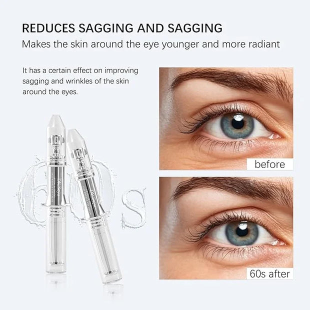 Under Eye Cream for Dark Circles, Temporary Eye Tightener, Crema Para Las Ojeras Bags Treatment for Women Cream for Puffin...