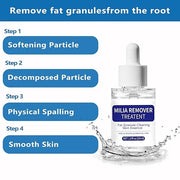 Milia Remover Treatment Serum, Milia Remover for Eyes & Face，Deep Clear to Get Glow Skin 0.85 oz - Product Image