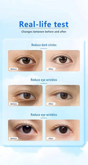 24K Gold Under Eye Treatment Mask, Dark Circle and Anti-Wrinkle, Hydrating eye mask, Puffiness & Eye Care, Collagen,Hyalur...