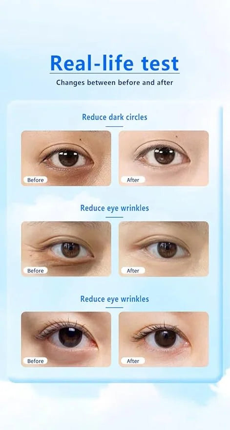 24K Gold Under Eye Treatment Mask, Dark Circle and Anti-Wrinkle, Hydrating eye mask, Puffiness & Eye Care, Collagen,Hyalur...