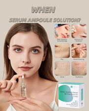 Centella Asiatica Serum for Face with Hyaluronic Acid Repair and Centella Serum for Face Moisturizer 0.35 oz 4 Vials Serum...