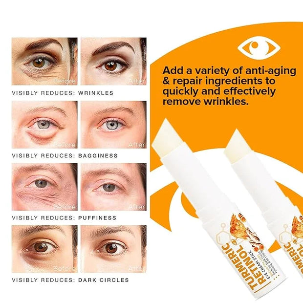 2 PCS Turmeric Retinol Eye Stick,Eye Balm Stick Hydrating for Dark Circle,Wrinkles,Visible Results in 3-4 Weeks,Anti Aging...