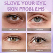 Collagen Eye Cream Anti Aging - Under Eye Cream for Dark Circles - Retinol Eye cream - Firming Eye Serum - for Puffiness a...