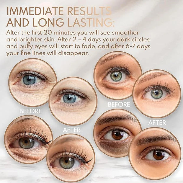 Under Eye Anti-Aging Eye Mask Collagen Patch Treatment for Minimizing Wrinkles, Puffy Eyes, Eye Bags, Dark Circles, Fine L...