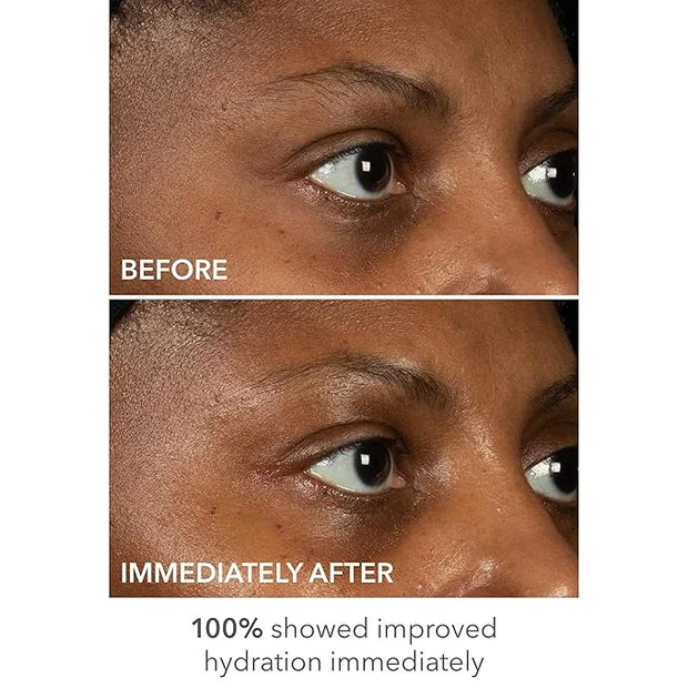 Dr Dennis Gross DermInfusions Lift + Repair Eye Mask | Visibily Lift + Firm, Fills the Appearance of Fine Lines, Hydrates ...