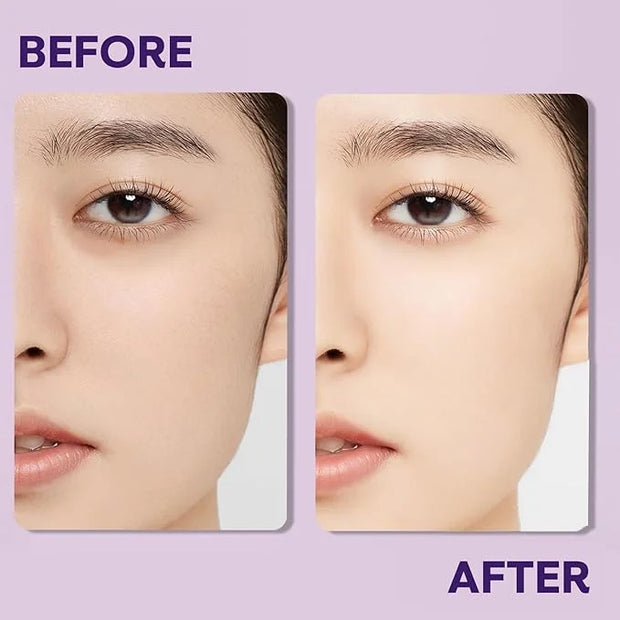 Eye Cream for Bag Under the Eyes, Dark Circles, Swelling Treatment, Anti-aging, Minimizes Wrinkles, Moisturizing Eyes Crea...