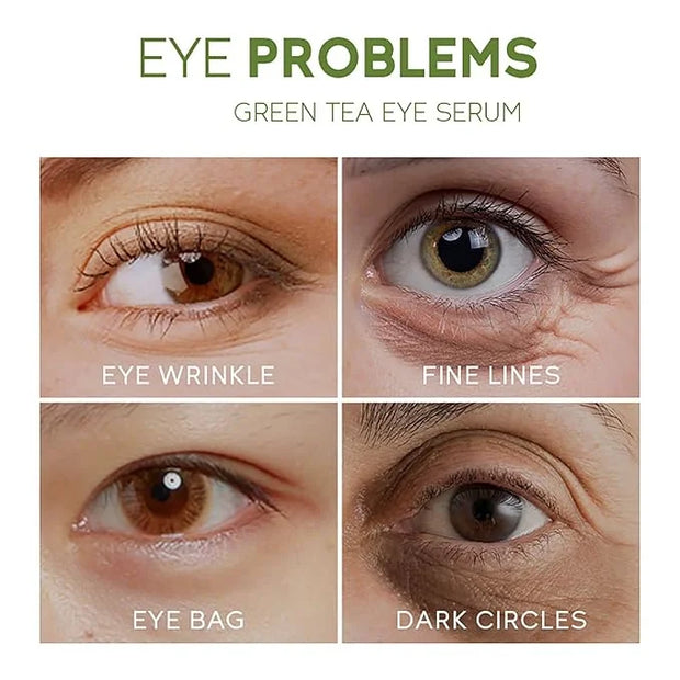 AKARY Green Tea Eye Serum and Under Eye Roller Cream, for Eye Bags Puffiness, Caffeine Eye Cream with 360° Massage Ball Re...