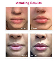 LifeCell Lip Plumping Treatment – Glossy Balm with MaxiLip Peptides for Fuller, Smoother Lips – Hydrating, Non-Irritating,...