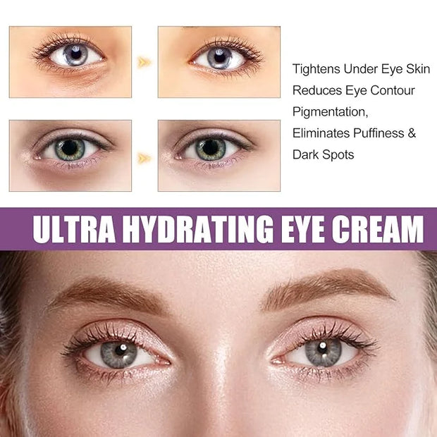 Eye Serum Under Eye Cream, Dark Circle and Puffiness Treatment - Hydrating Eye Cream for Wrinkles, Reduce Fine Lines, Bags...