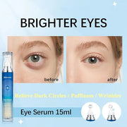 Eye Serum with Roller ball, 15 ML Eye Cream for Dark Circles and Puffiness, Anti-Aging Under Eye Roller Cream Reduce Wrink...