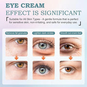 Retinol Eye Cream for Dark Circles & Wrinkles–Brighten & Smooth– Anti-Aging Under Eye Treatment with Retinol & Hyaluronic ...