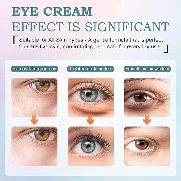 Retinol Eye Cream for Dark Circles & Wrinkles–Brighten & Smooth– Anti-Aging Under Eye Treatment with Retinol & Hyaluronic ...