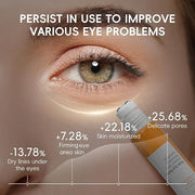 Easilydays Vitamin C Eye Cream & Under Eye Serum, Refreshing, Hydrating, Radiant Glow Eye Care Eye Roller Serum with 360° ...