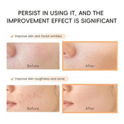 Snail Mucin Cream, 97.5% Pure Snail Slime Extract Moisturizer for Face and Body, Snail Mucin Essence 92% Snail Slime Serum...