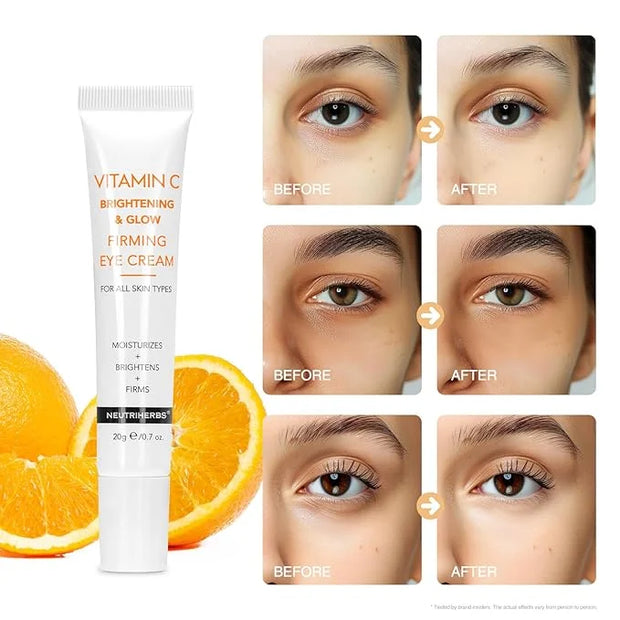 Neutriherbs Eye Cream Vitamin C Eye Gel for Dark Circles, Eye Bags, Puffiness, Eye Massage Under Eye with Hyaluronic Acid,...