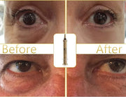 GLO24K Complete Eye Care Set with our 24k Instant Facelift Cream, Eye Cream, and Eye Serum - Product Image