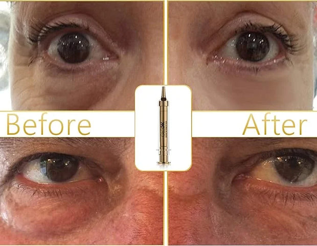 GLO24K Complete Eye Care Set with our 24k Instant Facelift Cream, Eye Cream, and Eye Serum - Product Image
