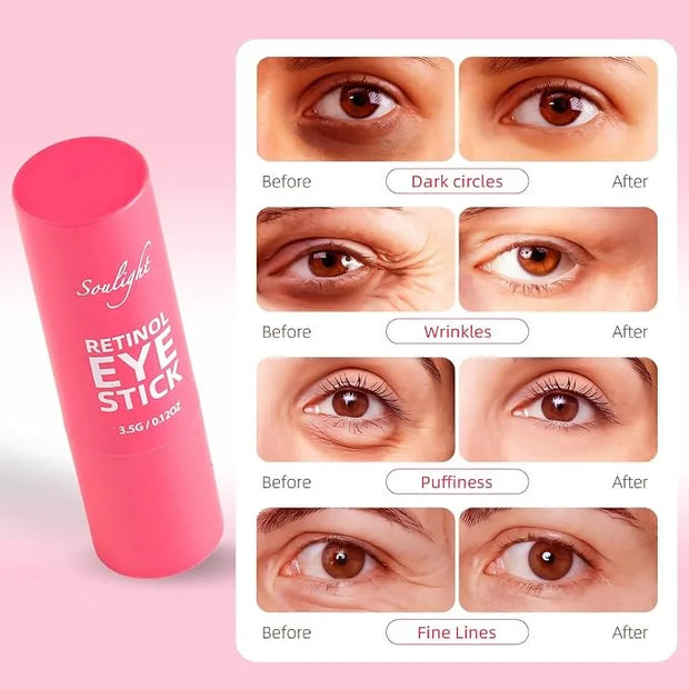 Soulight Retinol Eye Stick, Anti-Aging Eye Cream, Skincare for Wrinkles, Dark Circles, Puffiness - Retinol Eye Balm Moistu...