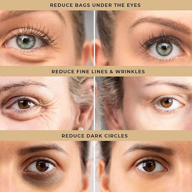 Temporary Eye Tightener Eye Cream for Under-Eye Bags, Dark Circles & Puffiness, Anti Aging Fine Lines, Firm That Delicate ...