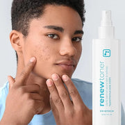 BRIOTECH Renew Toner, Hypochlorous Acid Spray, Minimize Appearance of Blemishes, Soothing Facial Mist for Sensitive Skin, ...