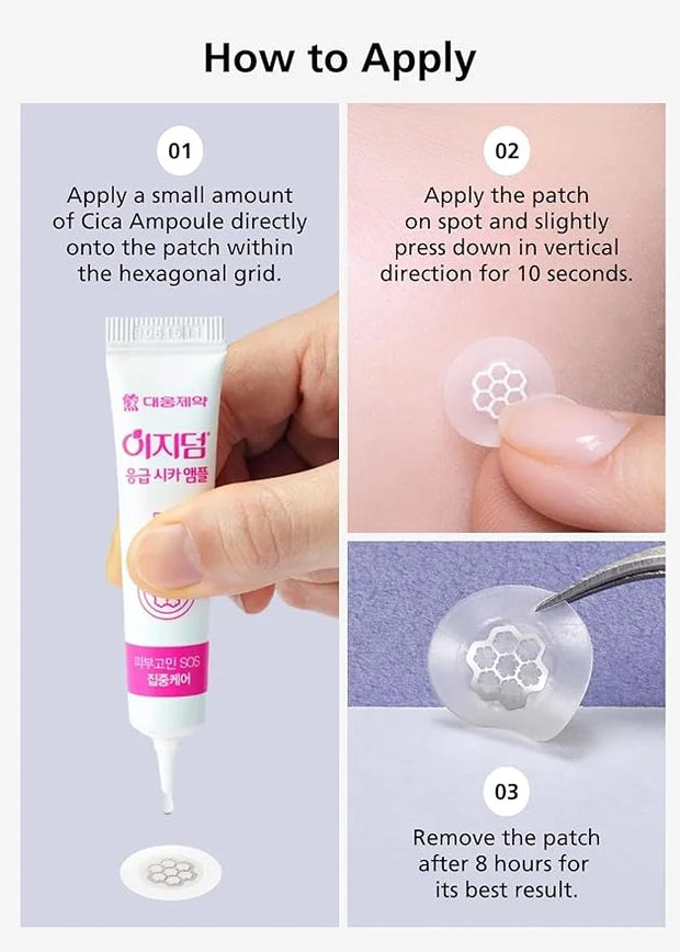 EasyDerm Quick Calming Magnesium Patches – Hydrocolloid Acne Spot Treatment Includes Tweezers & Ampoule, 10 Patches, Zit S...