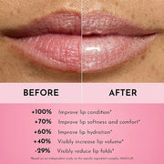 Forget the Filler Lip Plumping Line Smoothing Gloss - Candy Sky - Premium Volumizing Lip Gloss with Natural Ingredients De...