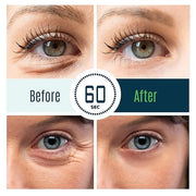 Puffy Eye Treatment Time Reverse Instant Anti-aging Eye Cream New Advanced Formula - Visibly Reduce Under-eye Bags, Wrinkl...