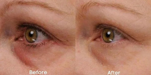 Renew & Firm Eye Serum - Product Image
