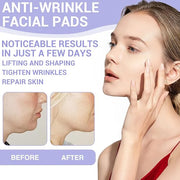 108PCS Smile Line Wrinkle Patches, Facial Frown Crows Feet Wrinkle Patches - Product Image