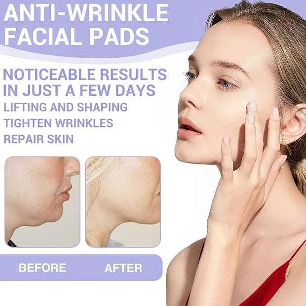 108PCS Smile Line Wrinkle Patches, Facial Frown Crows Feet Wrinkle Patches - Product Image