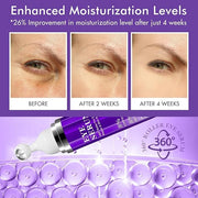 Under Eye Roller Serum|5% Caffeine 5% Retinol Eye Cream for Dark Circles, Puffiness and Bags, Puffy Bags Fine Lines Wrinkl...