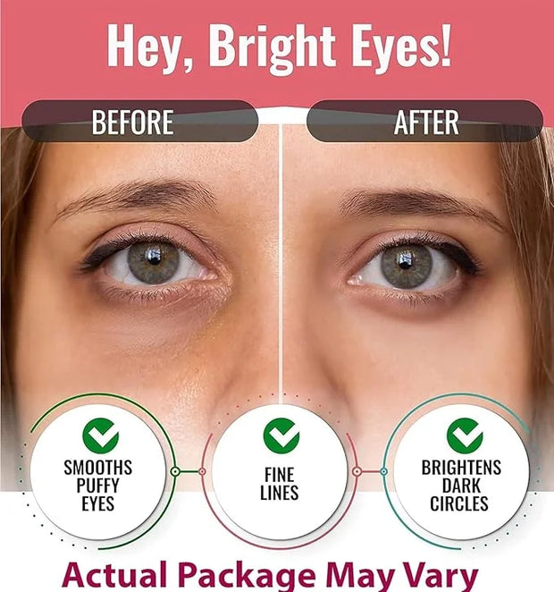 Look At Me Under Eye Patches (10 Pairs). Korean Skin Care Green Tea Hydrogel Eye Patch/Eye Pads. Dark Circle Remover and C...