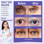 Serfeymi 22 Packs Steam Eye Masks Self Heating Warm Eye Mask, Disposable Eye SPA Heated Eye Mask for Sleeping,Relief Eye F...