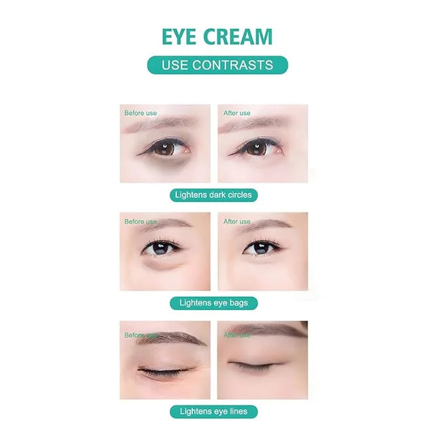 Caffeine Eye Cream, 2.5% Activity Retinol Eye Cream For Puffiness And Bags Under The Eyes Deep Moisturizing Anti-Wrinkle A...