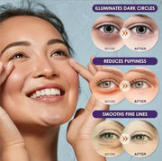 Purederm Biome Energizing Under Eye Mask (4 Pack) – Rich Biome Under Eye Patches for improving skin barrier & Moisturizing...
