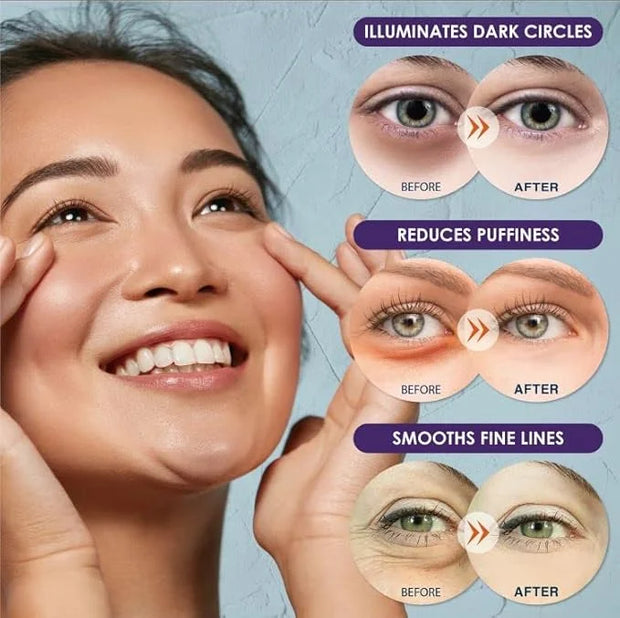 Purederm Biome Energizing Under Eye Mask (4 Pack) – Rich Biome Under Eye Patches for improving skin barrier & Moisturizing...