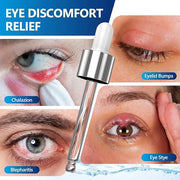 Stye Eye Treatment Serum, Eye Stye Remover for Chalazion, Blepharitis & Stye Removal, Natural Stye Eye Drops, Safe & Fast ...
