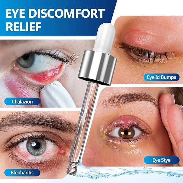 Stye Eye Treatment Serum, Eye Stye Remover for Chalazion, Blepharitis & Stye Removal, Natural Stye Eye Drops, Safe & Fast ...