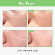 Green Tomato Pore Ampoule with Green Tomato, Witch Hazel and Hyaluronic Acid for Face Moisturizer and Pore Minimizing Trea...