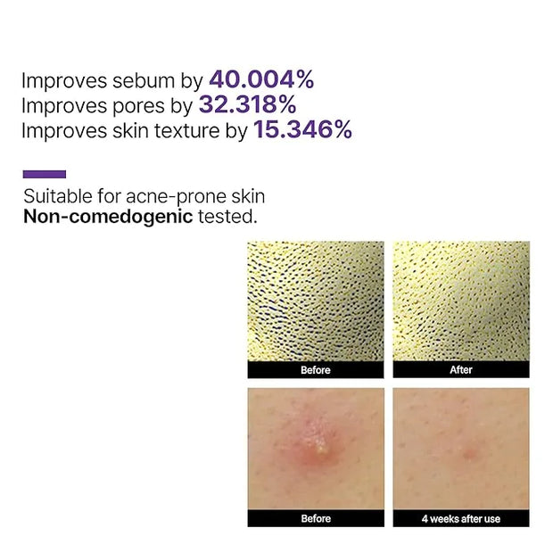 SOME BY MI Retinol Intense Reactivating Serum 50ml + Retinol Intense Advanced Triple Action Eye Cream - Product Image