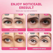 POSTA 20Pairs/40Pcs Collagen Under Eye Patches, Glitter Under Eye Mask for Dark Circles and Puffiness, Hydrating Eye Skinc...