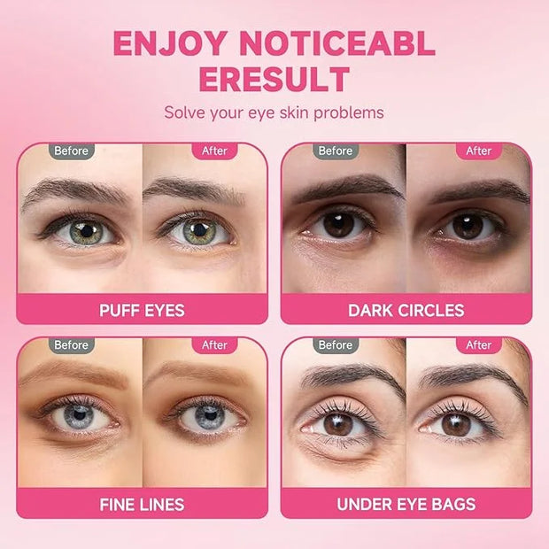 POSTA 20Pairs/40Pcs Collagen Under Eye Patches, Glitter Under Eye Mask for Dark Circles and Puffiness, Hydrating Eye Skinc...