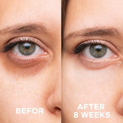 Epielle Brightening Eye Cream | Anti-Aging Serum for Dark Circles & Wrinkles | Cooling Applicator for Refreshing Applicati...