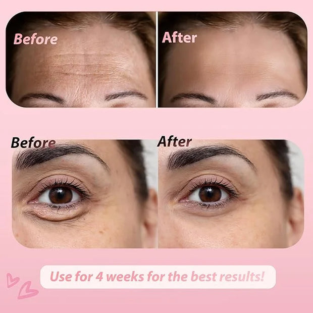 JJ&G's Forehead & Under Eye Anti Wrinkle Patches Bundle | Collagen Irish Sea Moss Vitamin C | Overnight Smoothing Treatmen...